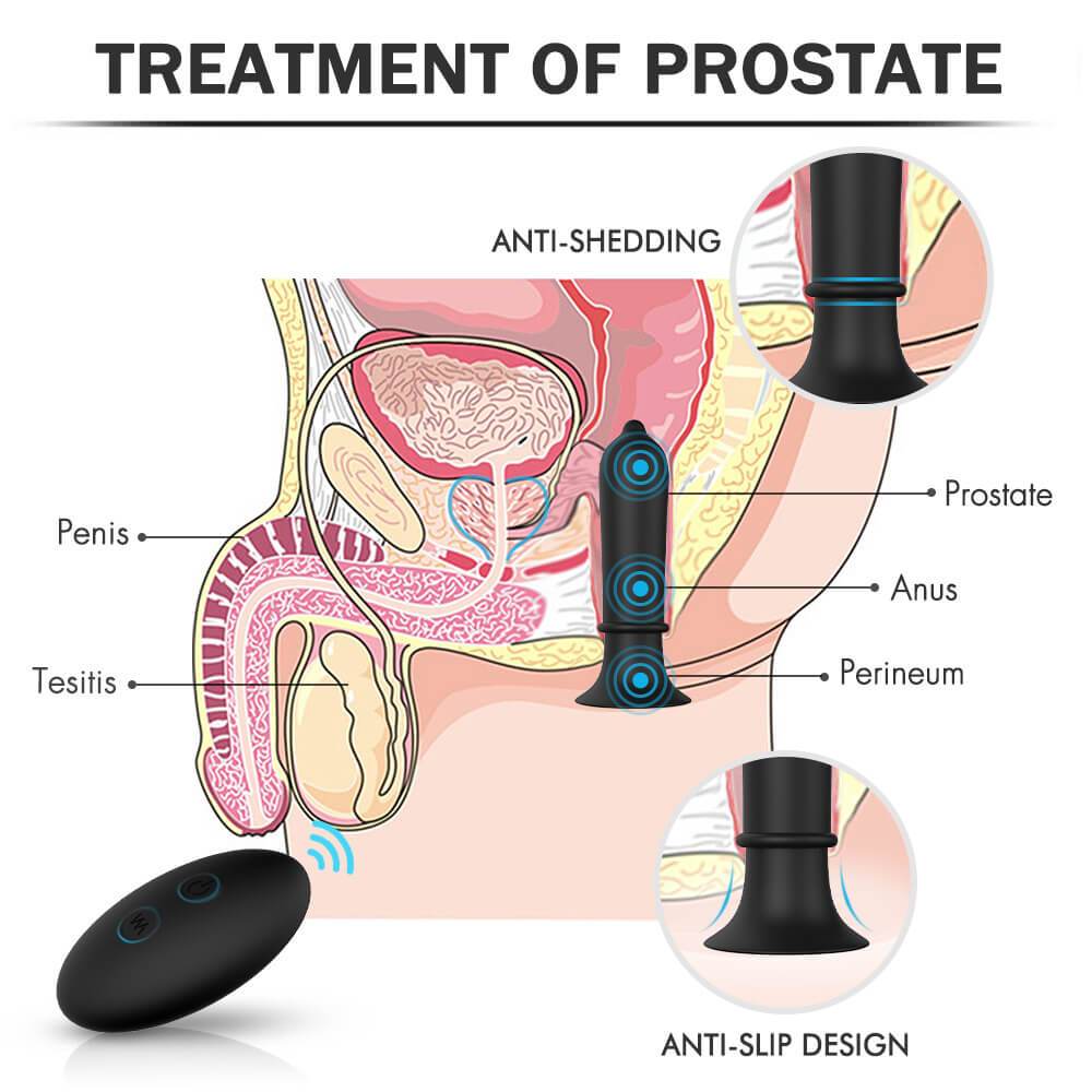 S-Hande Reddit Prostate Massage